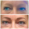 eyebrows before and after