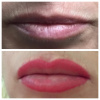 lips before and after